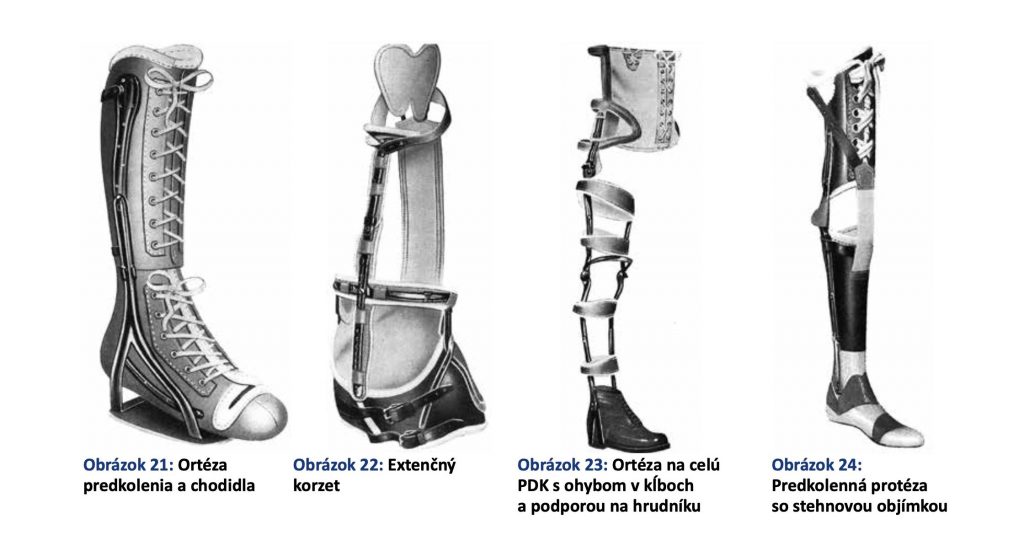 História ortopedickej protetiky 