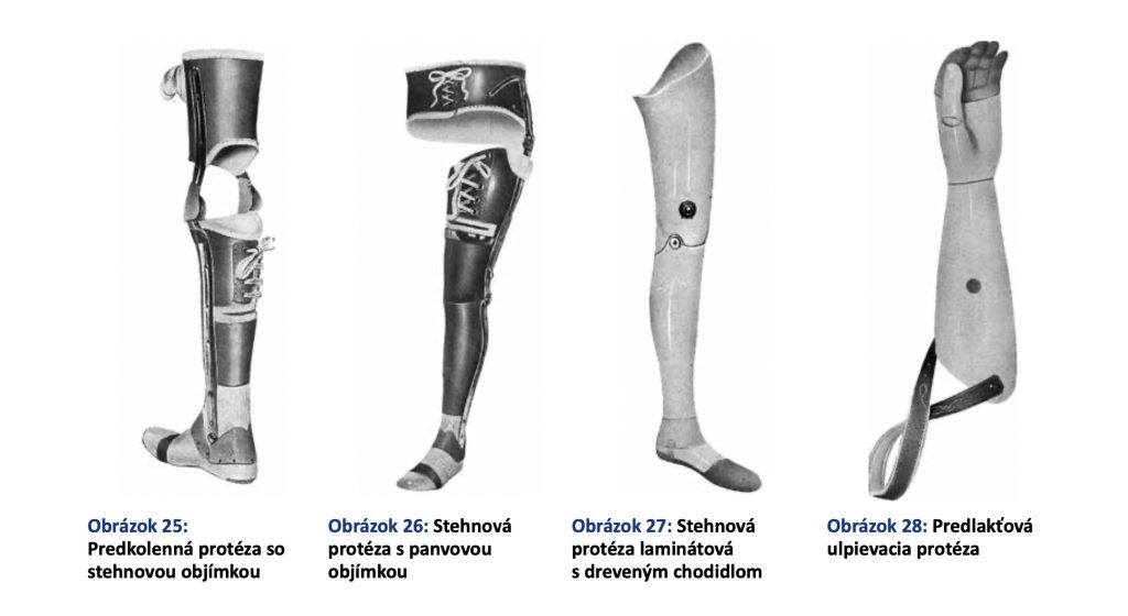 stehenné protézy 