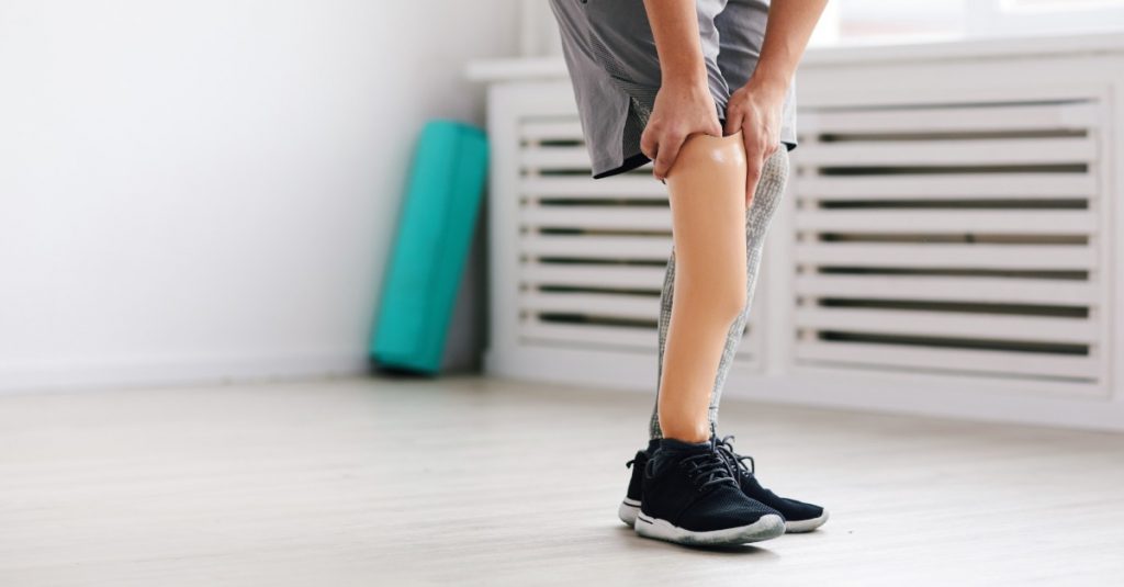 Či sa pacient stotožní s novou protézou závisí od jej vzhľadu a úrovne poskytovanej mobility