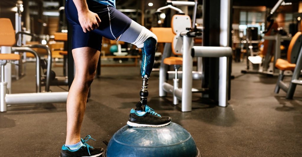 SKOrT: Najnovšie technológie využívané v ortopedickej protetike a technike
