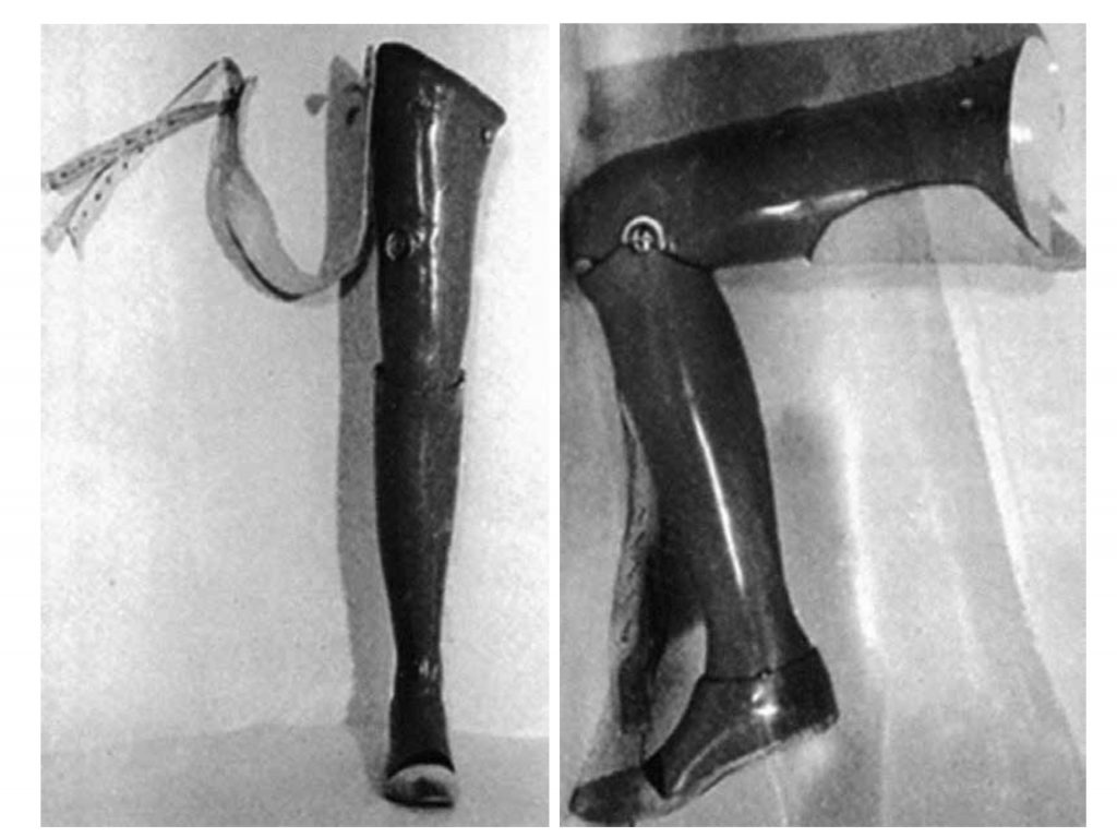 História remeselnej výroby ortopedických pomôcok
