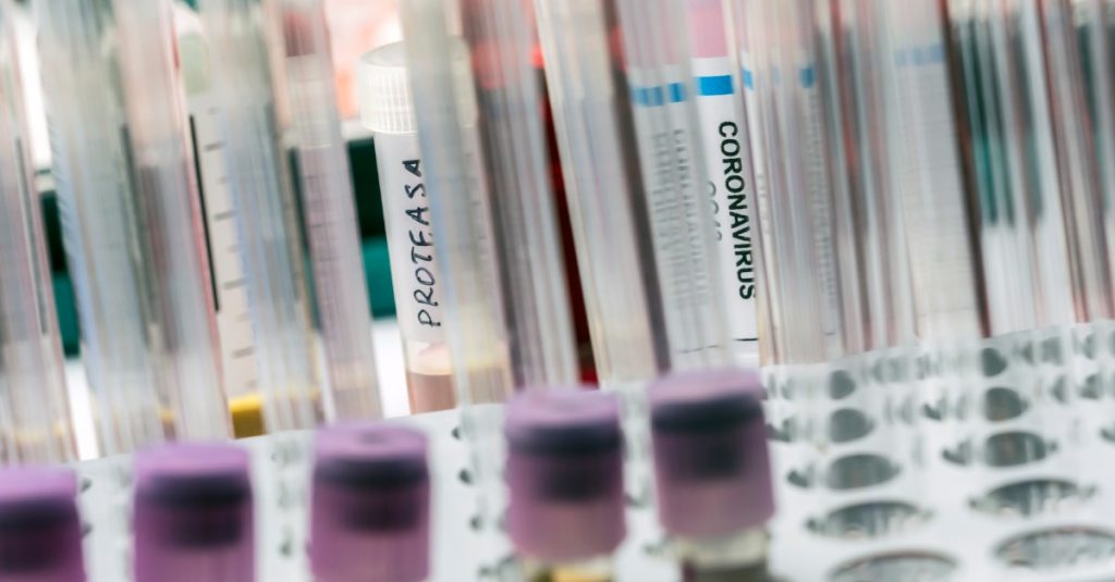 VšZP eviduje nárast výkonov na vyšetrenie protilátok na nový koronavírus o takmer 300 %