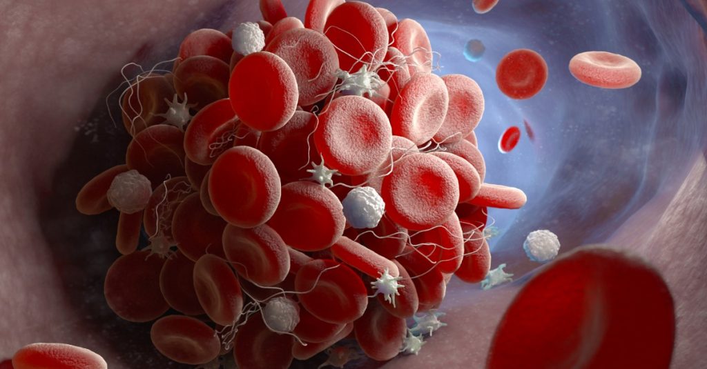Krvné zrazeniny ako vedľajšie účinky AstraZenecy