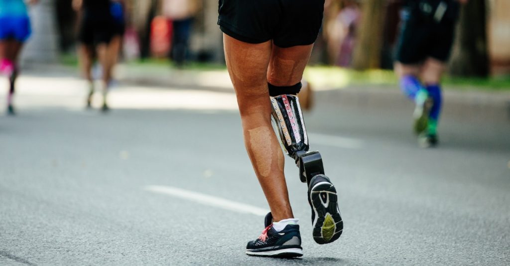 Použitie hydraulického členkového kĺbu zlepšuje rýchlosť chôdze s predkolennou protézou