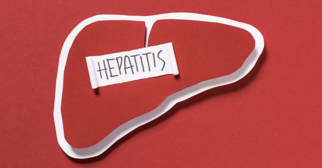 V minulom roku sme mali na Slovensku 11 prípadov hepatitídy typu A