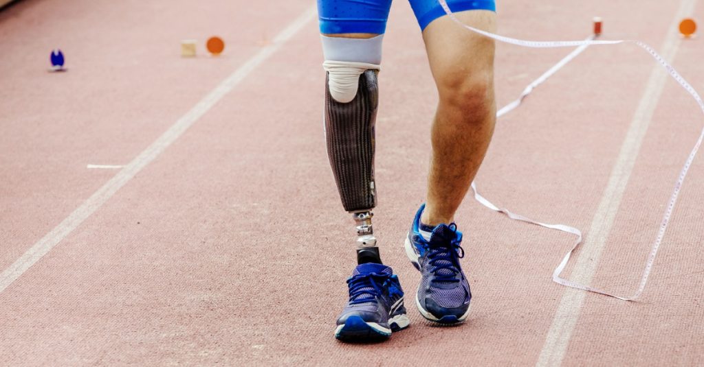 Význam mechanických vlastností protetického chodidla pre chôdzu s protézou 