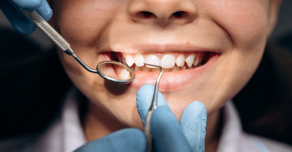 Prvá návšteva zubára, kedy by se ju mali absolvovať so svojim dieťaťom?