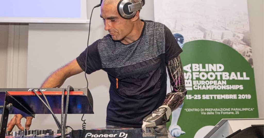 DJ Miky Bionic je hrdý na svoje protézy