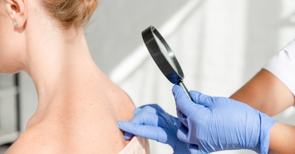 Kožní lekári oceňujú lepšiu dostupnosť biologickej liečby pre pacientov so psoriázou