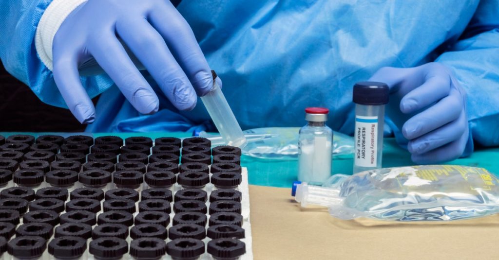 Nemecké laboratóriá už narážajú pri PCR testoch na svoje kapacitné limity